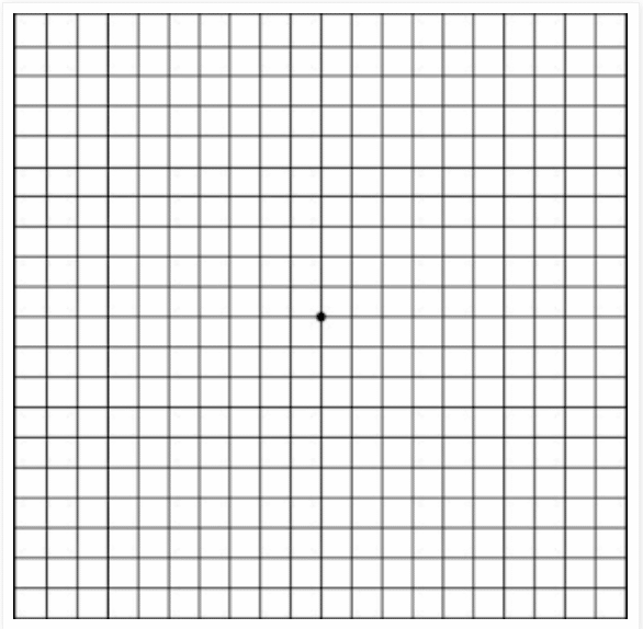 How to use the amsler grid - Towne Lake Eye Associates